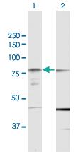 Anti-PRKCH Rabbit Polyclonal Antibody