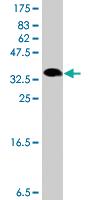 Anti-RRM1 Mouse Polyclonal Antibody