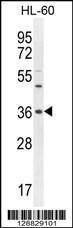 Anti-OR1J4 Rabbit Polyclonal Antibody