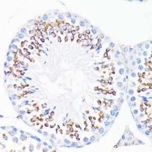 Immunohistochemistry analysis of paraffin-embedded mouse testis using Anti-Cathelicidin / CLP Antibody (A11466) at a dilution of 1:200 (40x lens). Perform microwave antigen retrieval with 10 mM PBS buffer pH 7.2 before commencing with IHC staining protocol.