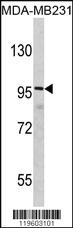 Anti-DLGAP1 Rabbit Polyclonal Antibody