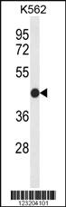 Anti-CLDN15 Rabbit Polyclonal Antibody