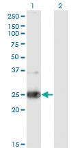 Anti-NXPH3 Mouse Monoclonal Antibody [clone: 4C8]