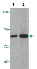 Anti-TRIM71 Rabbit Polyclonal Antibody