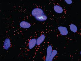 Anti-FGFR2 + FGF10 Antibody Pair