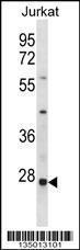 Anti-HTATIP2 Rabbit Polyclonal Antibody (AP (Alkaline Phosphatase))