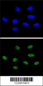 Anti-PIN1 Rabbit Polyclonal Antibody (FITC (Fluorescein Isothiocyanate))