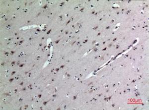 Immunohistochemical analysis of paraffin-embedded human brain using Anti-MDK Antibody