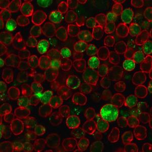 Anti-MSH2 Mouse Monoclonal Antibody [clone: MSH2/2622]