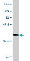 Anti-RRM1 Mouse Monoclonal Antibody [clone: 4E4]