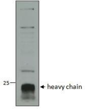 Anti-CTSC Antibody (A82634) (1 µg/ml) staining of Human Neutrophils lysate (35 µg protein in RIPA buffer). Data obtained from a customer. Detected by chemiluminescence