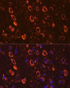 Immunofluorescence analysis of rat brain using Anti-Tau (phospho Ser416) Antibody (A308895) at a dilution of 1:100. DAPI was used to stain the cell nuclei (blue)