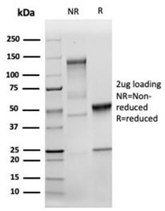 SDS-PAGE analysis of Anti-MSH2 Antibody [MSH2/6549R] under non-reduced and reduced conditions; showing intact IgG and intact heavy and light chains, respectively. SDS-PAGE analysis confirms the integrity and purity of the antibody