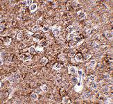 Anti-IL16 Rabbit Polyclonal Antibody