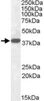 Anti-EPM2A Goat Polyclonal Antibody