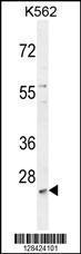 Anti-SLC25A52 Rabbit Polyclonal Antibody (AP (Alkaline Phosphatase))