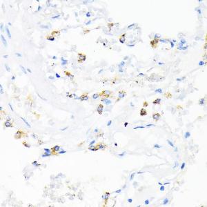 Immunohistochemistry analysis of paraffin-embedded human lung using Anti-Cathelicidin / CLP Antibody (A11466) at a dilution of 1:200 (40x lens). Perform microwave antigen retrieval with 10 mM PBS buffer pH 7.2 before commencing with IHC staining protocol.