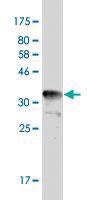 Anti-TYMS Mouse Monoclonal Antibody [clone: 2B2]