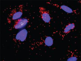 Anti-FGFR2 + FGF8 Antibody Pair