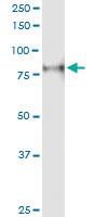 Anti-PRKCH Rabbit Polyclonal Antibody