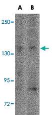 Anti-IL16 Rabbit Polyclonal Antibody