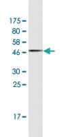 Anti-RRM1 Mouse Monoclonal Antibody [clone: 1D6]