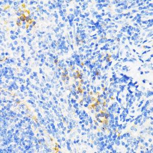 Immunohistochemistry analysis of paraffin-embedded mouse spleen using Anti-Cathelicidin / CLP Antibody (A11466) at a dilution of 1:200 (40x lens). Perform microwave antigen retrieval with 10 mM PBS buffer pH 7.2 before commencing with IHC staining protocol.