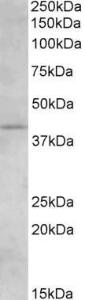 Anti-CNR2 Antibody (A84133) (15 µg/ml) staining of Human Brain (Hippocampus) lysate (35 µg protein in RIPA buffer) Primary incubation was 1 hour Detected by chemiluminescence