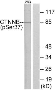 Anti-Catenin-beta