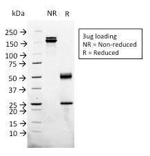 SDS-PAGE analysis of Anti-Glypican 3 Antibody [1G12] under non-reduced and reduced conditions; showing intact IgG and intact heavy and light chains, respectively. SDS-PAGE analysis confirms the integrity and purity of the antibody.