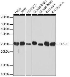 Western blot analysis of extracts of various cell lines, using Anti-HPRT Antibody [ARC1300] (A305963) at 1:1000 dilution. The secondary Antibody was Goat Anti-Rabbit IgG H&L Antibody (HRP) at 1:10000 dilution. Lysates/proteins were present at 25 µg per lane