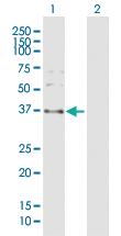 Anti-SPARC Rabbit Polyclonal Antibody