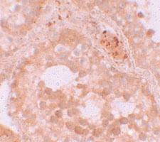 Anti-WDR92 Rabbit Polyclonal Antibody