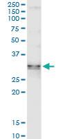 Anti-SDCBP Polyclonal Antibody Pair