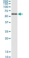 Anti-FGR Polyclonal Antibody Pair