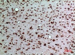 Immunohistochemical analysis of paraffin-embedded rat brain using Anti-MDK Antibody