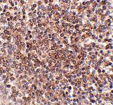 Anti-OCC1 Rabbit Polyclonal Antibody