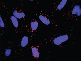 Anti-FGFR1 + FGF8 Antibody Pair