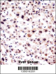 Anti-SNRPA Rabbit Polyclonal Antibody (FITC (Fluorescein Isothiocyanate))