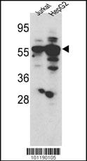 Anti-FSHB Mouse Monoclonal Antibody