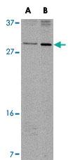 Anti-OCC1 Rabbit Polyclonal Antibody