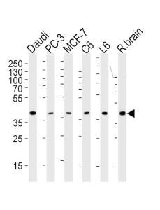 Anti-CREB3L4 Mouse Monoclonal Antibody [clone: 1165CT16.1.1]