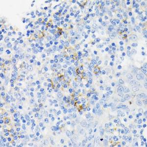 Immunohistochemistry analysis of paraffin-embedded human tonsil using Anti-Cathelicidin / CLP Antibody (A11466) at a dilution of 1:200 (40x lens). Perform microwave antigen retrieval with 10 mM PBS buffer pH 7.2 before commencing with IHC staining protocol.