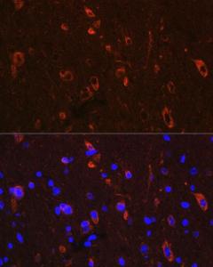 Immunofluorescence analysis of mouse brain using Anti-Tau (phospho Ser416) Antibody (A308895) at a dilution of 1:100. DAPI was used to stain the cell nuclei (blue)