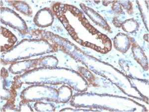 Immunohistochemical analysis of formalin-fixed, paraffin-embedded human kidney using Anti-E Cadherin Antibody [CDH1/4585]