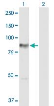 Anti-PRKCH Rabbit Polyclonal Antibody