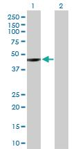 Anti-NEIL1 Rabbit Polyclonal Antibody