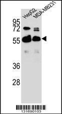 Anti-RAP1GDS1 Rabbit Polyclonal Antibody (APC (Allophycocyanin))