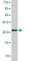 Anti-SORCS3 Mouse Monoclonal Antibody [clone: 3B12]