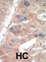 Anti-H3F3AP6 Rabbit Polyclonal Antibody